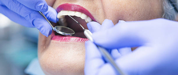 Best Broken or Chipped Tooth Repair in Antlers, OK